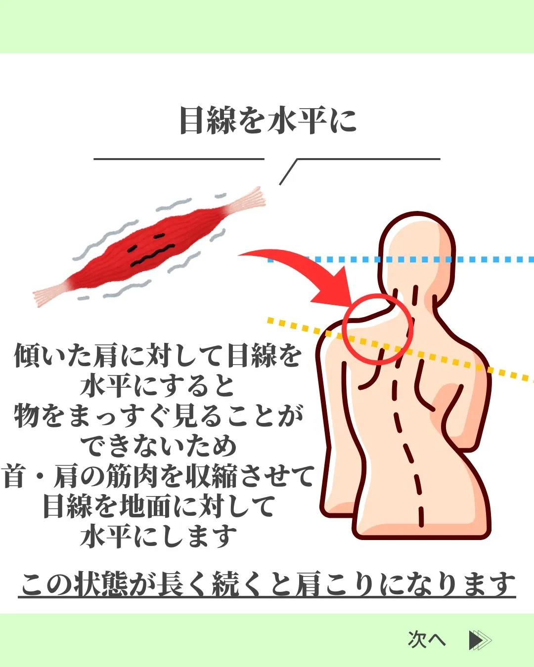 @suzuki_ebisu 👈施術の様子はリール動画をご覧く...