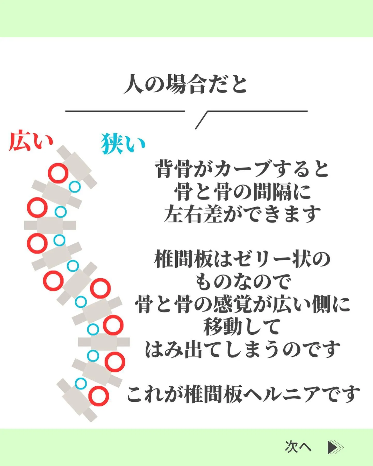 @suzuki_ebisu 👈施術の様子はリール動画をご覧く...