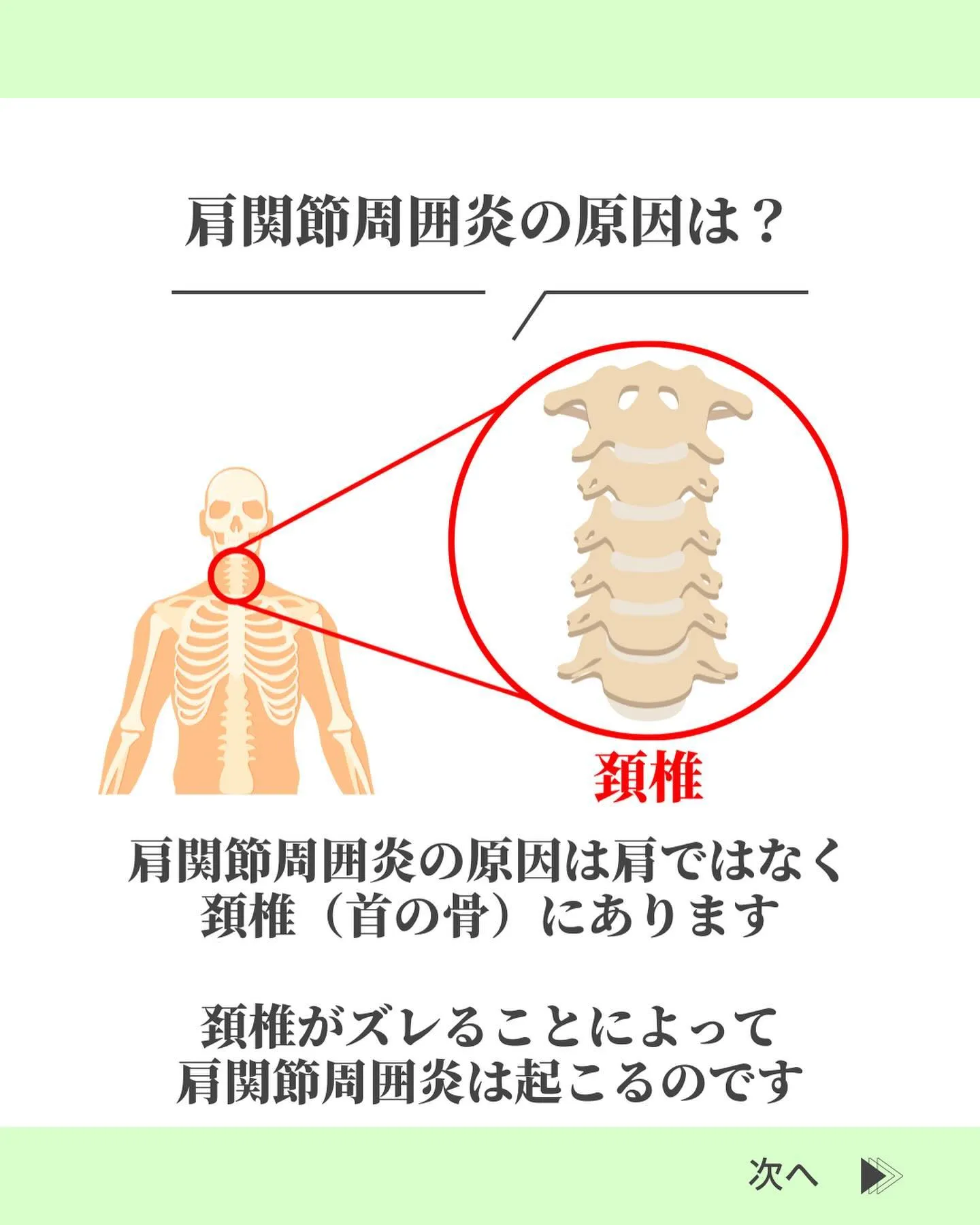 @suzuki_ebisu 👈施術の様子はリール動画をご覧く...